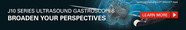 Learn more about the J10 Series Ultrasound Gastroscopes